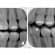 Digital X-ray can be Safe