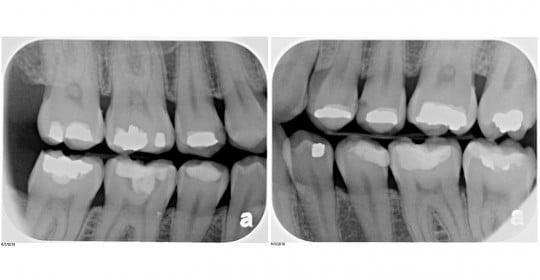 Digital X-ray can be Safe Digital X-ray can be Safe