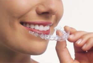  Invisalign for all ages 16 and up.